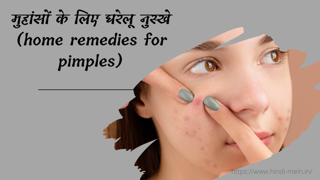 मुहांसों के लिए घरेलू नुस्खे (home remedies for pimples)